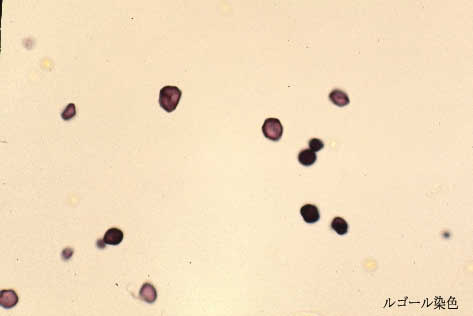 ���S�[�����F