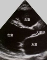 �g���^�S�؏�(�S�G�R�[)