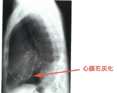 ���k���S����