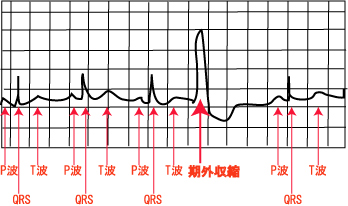 �S�[�����O���k