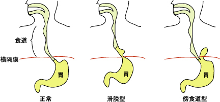 �H����E�w���j�A