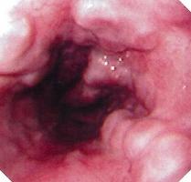 �H���Ö��