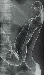 �|���|�[�V�X�������e