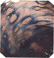 �|���|�[�V�X������