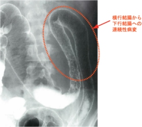 uc����X������