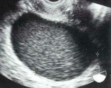 �`���R���[�g�X�E