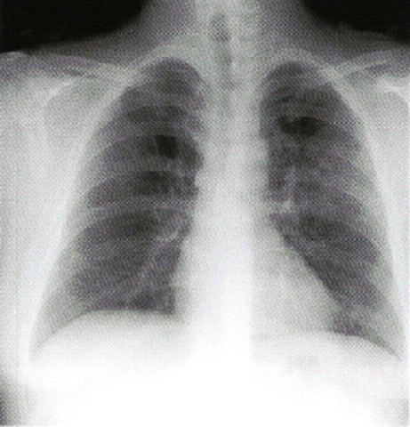 �}�C�R�v���Y�}�x��