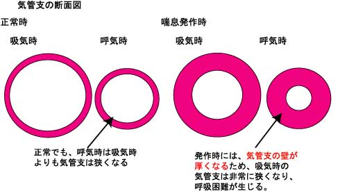 �C�ǎx�b��