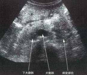 �X���̕����G�R�[