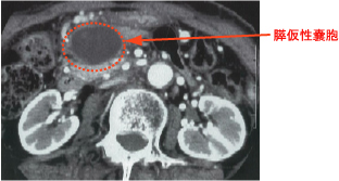 �X�����X�E