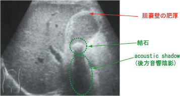 tanseki.jpg(40513 byte)